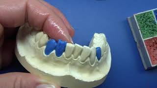 Mastering Dental WaxUp Dentes Incisivi 42 amp Dentes Canini 43 Tutorial [upl. by Shamrao578]