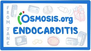 Clinicians Corner Endocarditis [upl. by Ahsuatal]