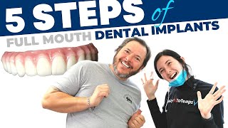 Full Mouth Dental Implant Procedure StepbyStep [upl. by Adnuhser585]