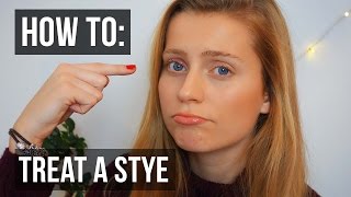 How to Treat a Stye in Your Eye QUICKLY  Ellesse [upl. by Soneson]